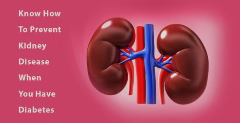 Diabetic kidney disease: Know how to prevent kidney disease when you have diabetes