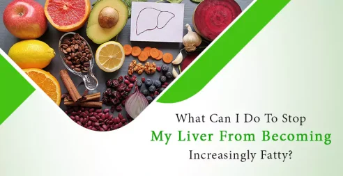 What Can I Do To Stop My Liver From Becoming Increasingly Fatty