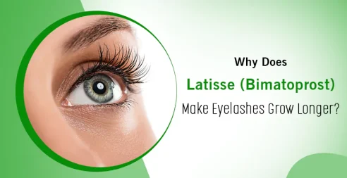 Why Does Latisse (Bimatoprost) Make Eyelashes Grow Longer