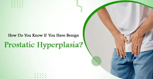 Do you know if you have benign prostatic hyperplasia