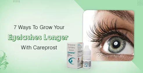 7 Ways To Grow Your Eyelashes Longer With Careprost