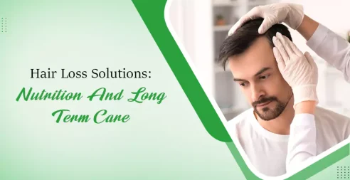 Hair Loss Solutions- Nutrition and Long-Term Care