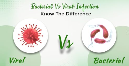 Bacterial Vs Viral Infection: Know The Difference
