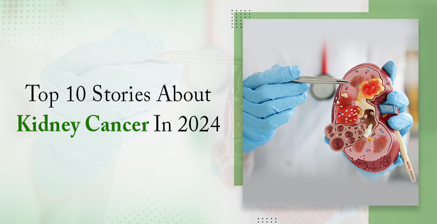 Top 10 Stories About Kidney Cancer In 2024