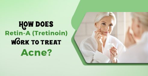 (Tretinoin) Work to Treat Acne?