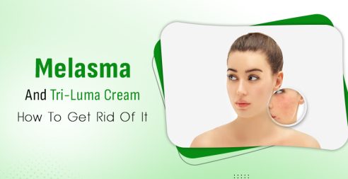 Melasma And Triluma Cream