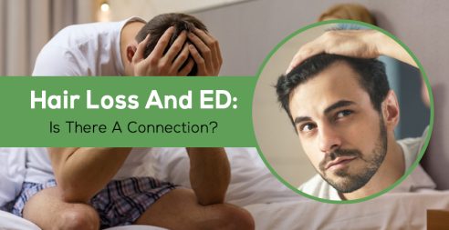 Hair Loss And Ed: Is There A Connection?