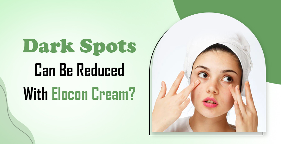 Dark Spots Can Be Reduced With Elocon Cream 1 Dark Spots Can Be Reduced Elocon Cream
