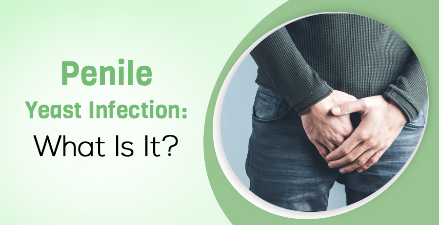 Penile Yeast Infection: What Is It? 1 Penile Yeast Infection