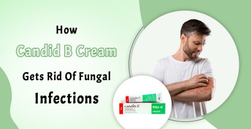 Candid B Cream Gets Rid Of Fungal Infections