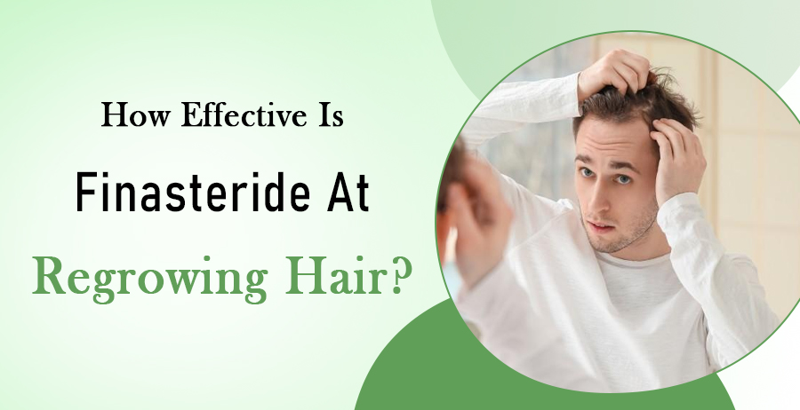 Finasteride Effectiveness For Hair Regrowth