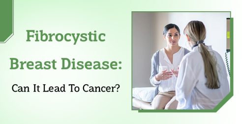 Fibrocystic Breast Disease