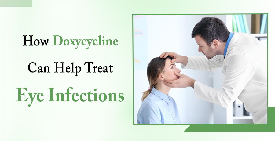 How Doxycycline Can Help Treat Eye Infections 1 Doxycycline Can Help Treat Eye Infections