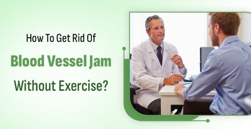 Blood Vessel Jam: How To Relieve It Without Exercise