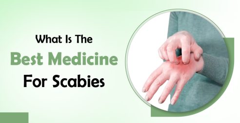Best Medicine For Scabies