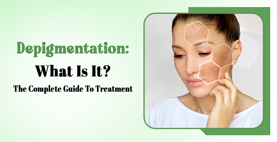 Depigmentation: What Is It? The Complete Guide To Treatment 1 Depigmentation: What Is It?