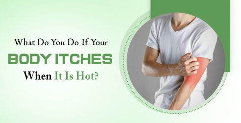 If Your Body Itches When It Is Hot?