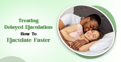 Treating Delayed Ejaculation: