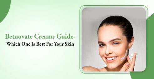 Betnovate Creams Guide