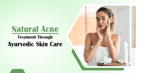 Ayurvedic Skin Care for Natural Acne Treatment