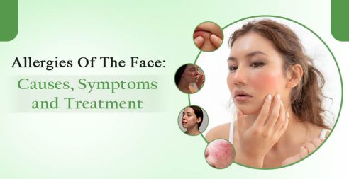 Allergies Of The Face- Causes, Symptoms