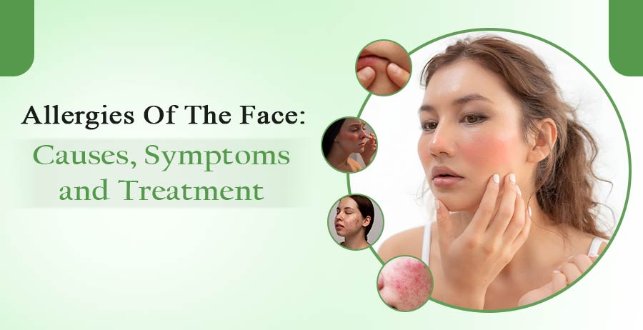 Allergies Of The Face- Causes, Symptoms