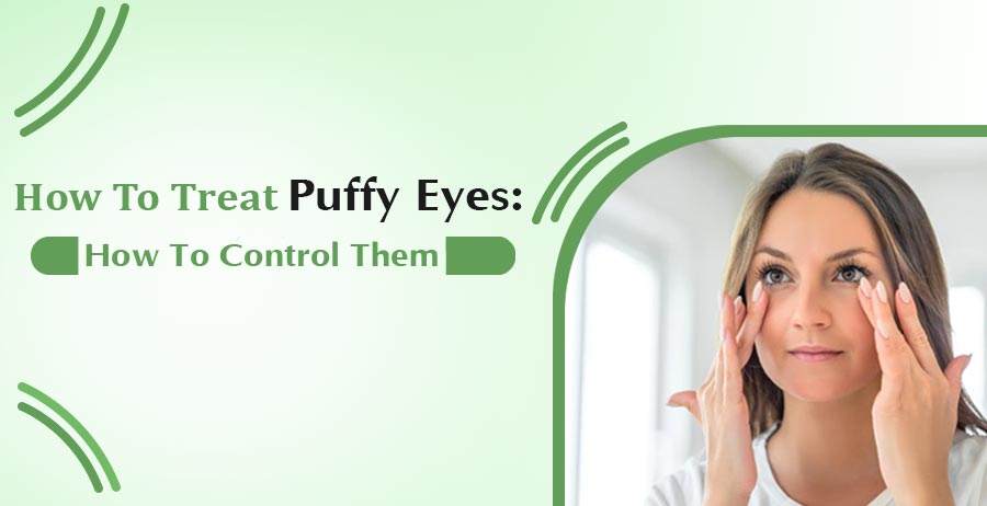 How To Treat Puffy Eyes