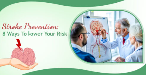 a stroke prevention plan 8 ways