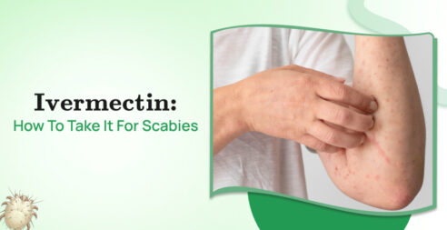 Ivermectin: How To Take It For Scabies