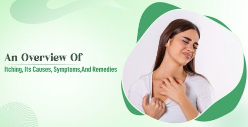 An Overview Of Itching