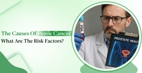 The Causes Of Penile Cancer